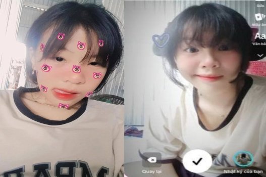 Bỏi nát bướm non đen