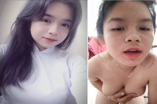 Em út mập bị dập đầu mệt nghỉ